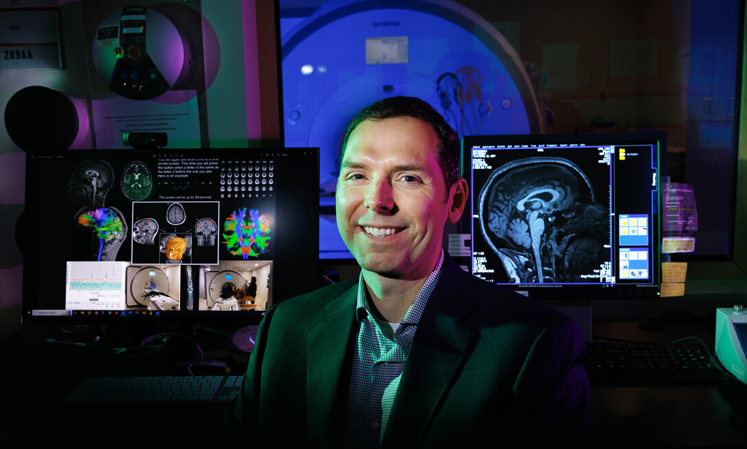 fMRI scans may improve diagnosis of sports-related concussion