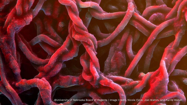A close view of Methanobacterium nebraskense (with false color) appears red and stringy.