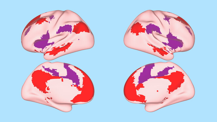 An illustration shows a map of relevant brain networks superimposed on the right hemisphere of the human brain.